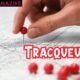 Tracqueur